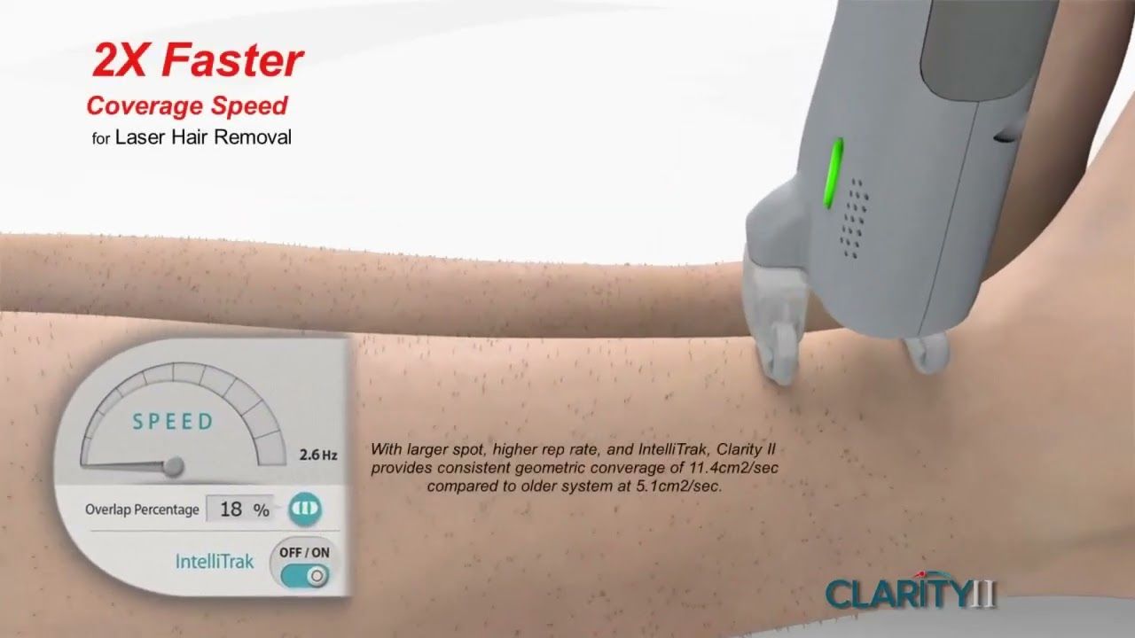 Laser hair removal device in use on skin.